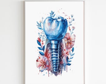 May include: A watercolor painting of a dental implant with a blue tooth crown and a silver screw. The implant is surrounded by pink and red flowers and leaves.
