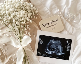 Floral Pregnancy Announcement Digital, Simple Spring Baby Announcement, NeutralGender Social Media Reveal Canva Editable Template, Aesthetic