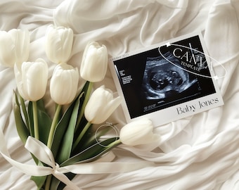 Floral Pregnancy Announcement Digital, Modern Baby Instant Social Media Reveal Canva Editable Template, Simple Neutral Aesthetic with Flower