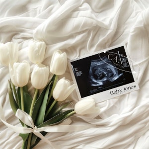 Floral Pregnancy Announcement Digital, Modern Baby Instant Social Media Reveal Canva Editable Template, Simple Neutral Aesthetic with Flower