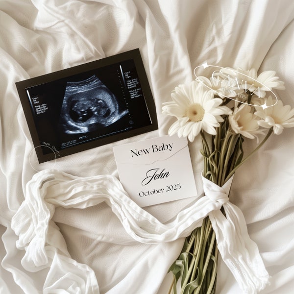 Editable Modern Pregnancy Announcement Digital, Floral Baby Instant Social Media Reveal Canva Template, Simple Neutral Aesthetic with Flower