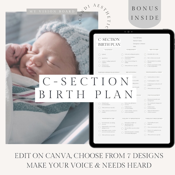 CSection Birth Plan CSection Template Cesarean Birth Plan Gentle C Section Birth Doula Handout