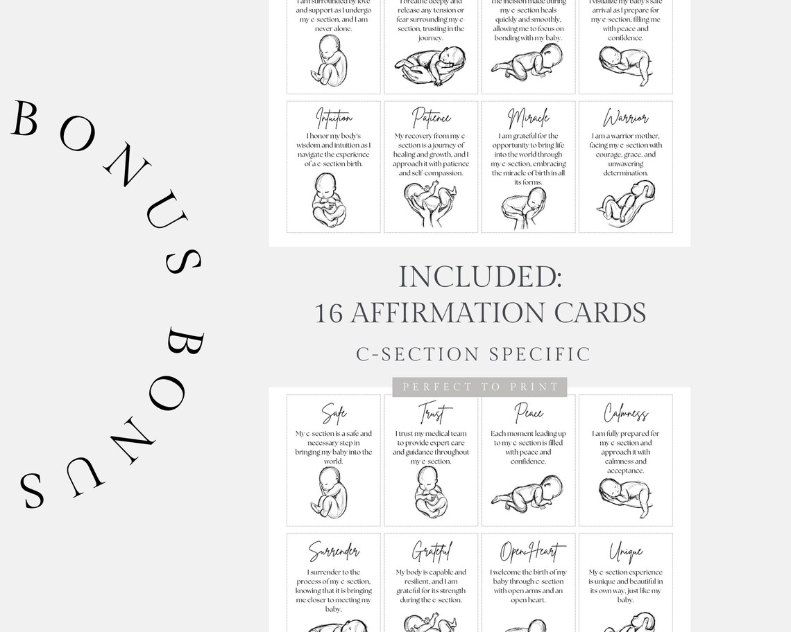 C section Birth Plan Template Cesarean Birth Plan Gentle C section c-section-birth-plan-template-cesarean-birth-plan-gentle-c-section
