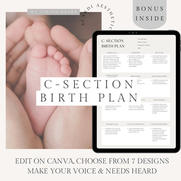 C-Section Birth Plan Template, Cesarean Birth Plan, Gentle C-Section, Birth Doula Handout