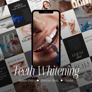 Teeth Whitening Instagram Templates, Canva Post and Story Designs for Dental Clinics (Digital Download)