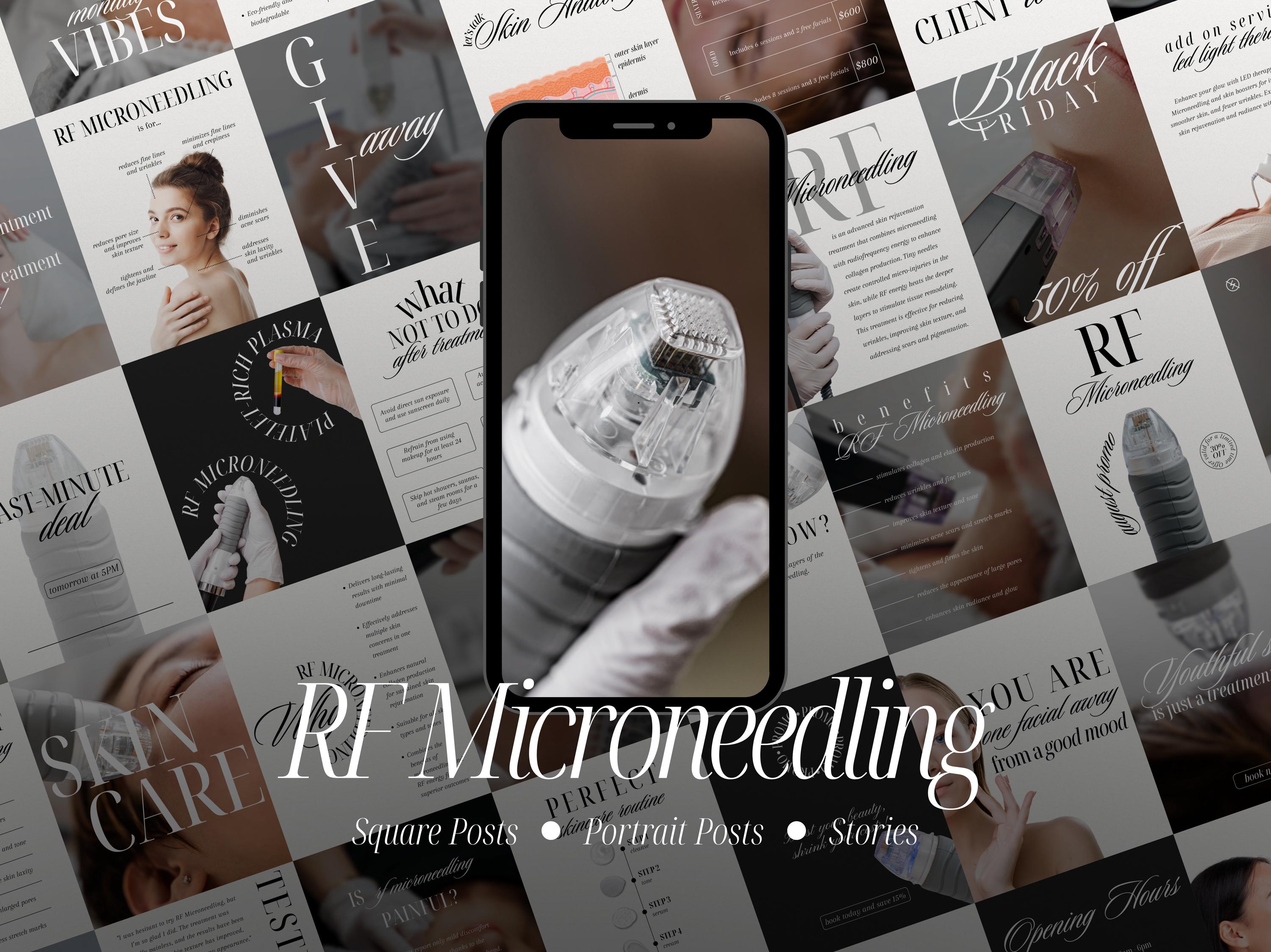 RF Microneedling Instagram Templates for Estheticians, MedSpa Social Media, Radiofrequency Facial Treatment Content, Canva, Skincare Posts