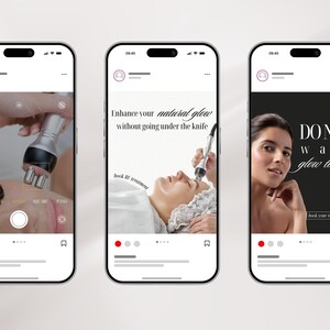 May include: Three smartphones displaying social media posts about radio frequency skin treatments. The screens show a camera interface, a person receiving a facial treatment with a handheld device, and a promotional graphic with the text DO NOT WAIT glow today!