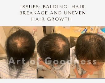 Hair Revival Rosemary and Oregano Hair Oil, Promote Healthy Scalp and Strong, Shiny Hair