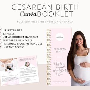 Puede incluir: Un folleto imprimible rosa y blanco con una encuadernación en espiral dorada. La portada del folleto presenta el texto "Parto por cesárea" y "Lo que toda mujer embarazada necesita saber". El folleto está diseñado para ser utilizado como un folleto para futuras madres.