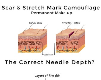 Permanent Make Up Needle Depth for Scar & Stretch Mark Camouflage, customized for every skin type with every client.
