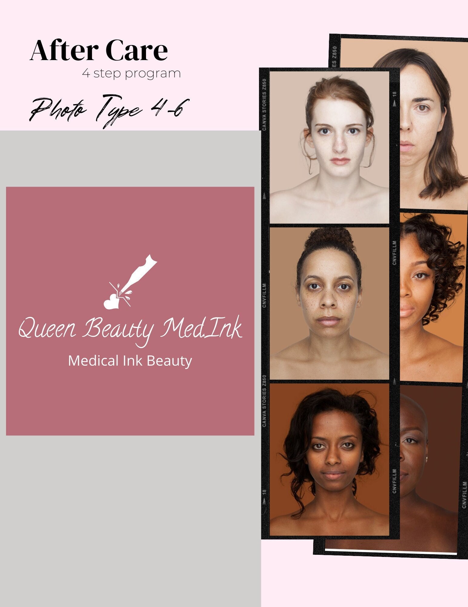 Stretch Mark rejuvenation After Care Steps 1-4 for all skin types