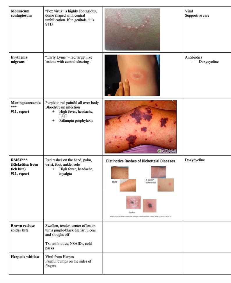 Rash Of Rmsf FNP Notes - ANCC/AANP Review Separated by Body System - Etsy