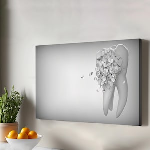 Stampa da parete con clinica odontoiatrica, dente cariato, stampa da dentista, stampa su tela minimalista, stampa su tela incorniciata, regali per inaugurazione della casa, grande stampa da parete