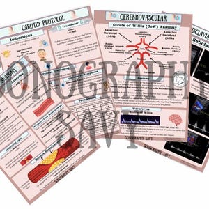May include: Four pink and white educational posters with diagrams and text about the anatomy of the brain and arteries. The posters are titled "Cerebrovascular", "Circle of Willis (CoW) Anatomy", "Carotid Protocol", and "Subclavian Steal".