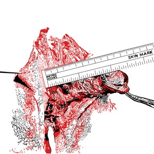 May include: A close-up of a red and black anatomical illustration with a ruler measuring in centimetres and inches. The ruler has the words "Metric Inches" and "Skin Mark" printed on it.