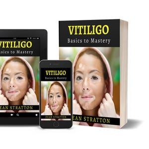 May include: A book, tablet, and smartphone display the cover of "VITILIGO Basics to Mastery" by Dean Stratton. The cover features a person with vitiligo wearing a pink hoodie. The title is in yellow text on a black background.