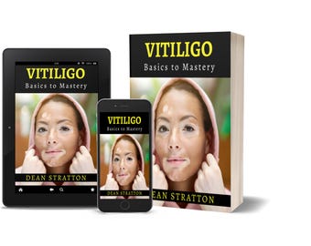 Vitiligo – Basics zur Beherrschung | Autoimmune Depigmentierungsanleitung: Diagnose, Behandlungen, Camouflage & Vertrauen