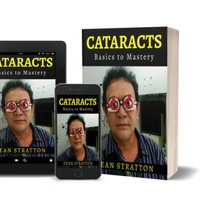May include: Image of a book, tablet, and smartphone displaying the book cover. The book and devices show a man wearing eye testing glasses. The title "CATARACTS Basics to Mastery" is in yellow text on a black background. The author's name is Dean Stratton.