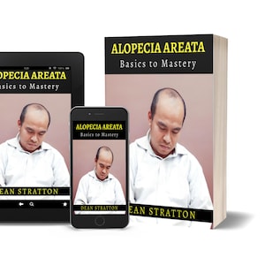 May include: An image featuring a book, tablet, and smartphone, all displaying the cover of "Alopecia Areata: Basics to Mastery" by Dean Stratton. The book is upright, while the tablet and phone show the cover image. The background is white.