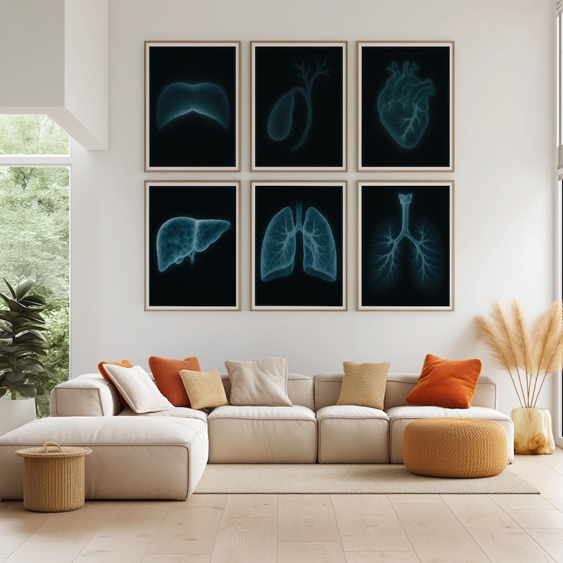 X-ray Anatomy Poster Set of 6 : Medical Wall Art (digital Download) - Etsy