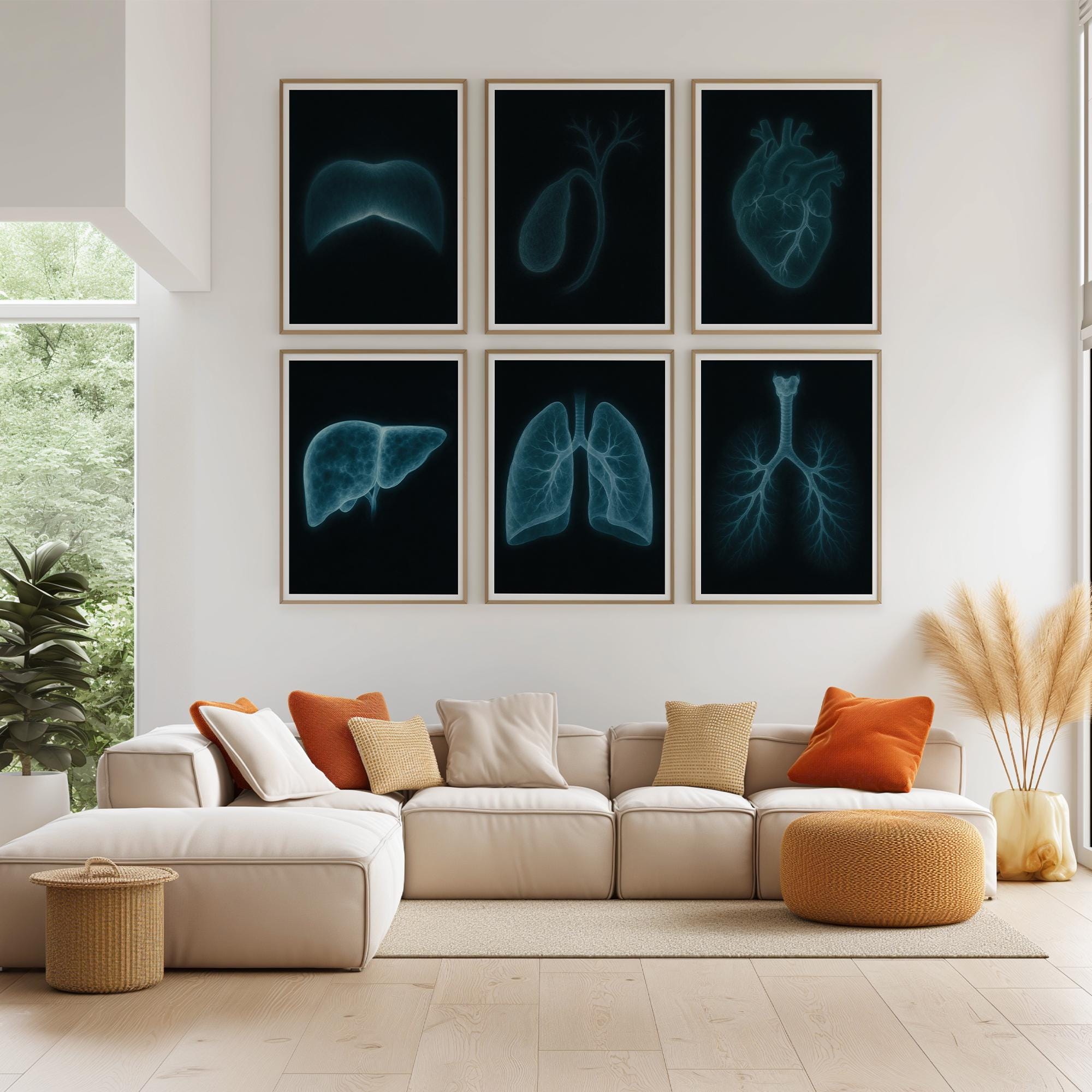 X-ray Anatomy Poster Set of 6 : Medical Wall Art (digital Download) - Etsy
