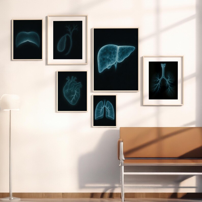 X-ray Organ Anatomy Poster Set of 6 : Medical Wall Art (digital ...
