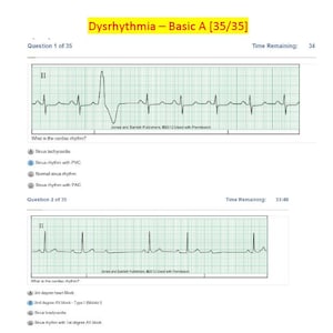 Relias Dysrhythmia Basic A Test 2023 Review Questions and Answers