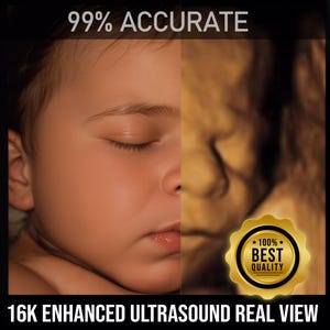 May include: A split image showing a baby's face and a 3D ultrasound image. The baby's face is in color, while the ultrasound is in shades of brown. Text at the top reads "99% ACCURATE" and at the bottom "16K ENHANCED ULTRASOUND REAL VIEW".