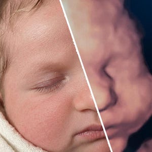 May include: A split-screen comparison showing a high-resolution photograph of a newborn baby's face on the left and a corresponding 3D ultrasound scan of a fetus on the right. The baby has light skin, closed eyes, and soft, fine hair.