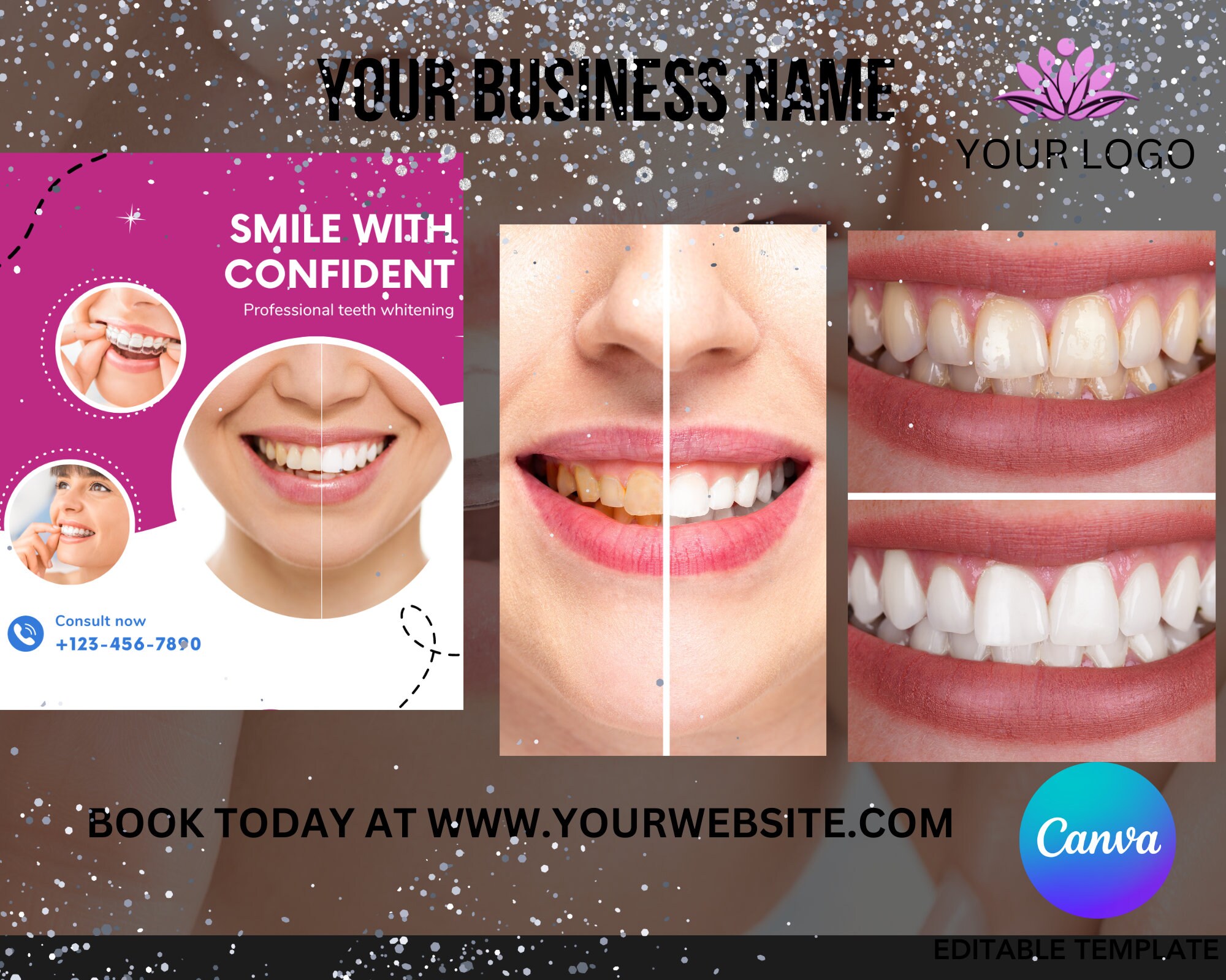 Teeth Whitening Flyer, Printable Flyer Design Template, Dentist Flyer