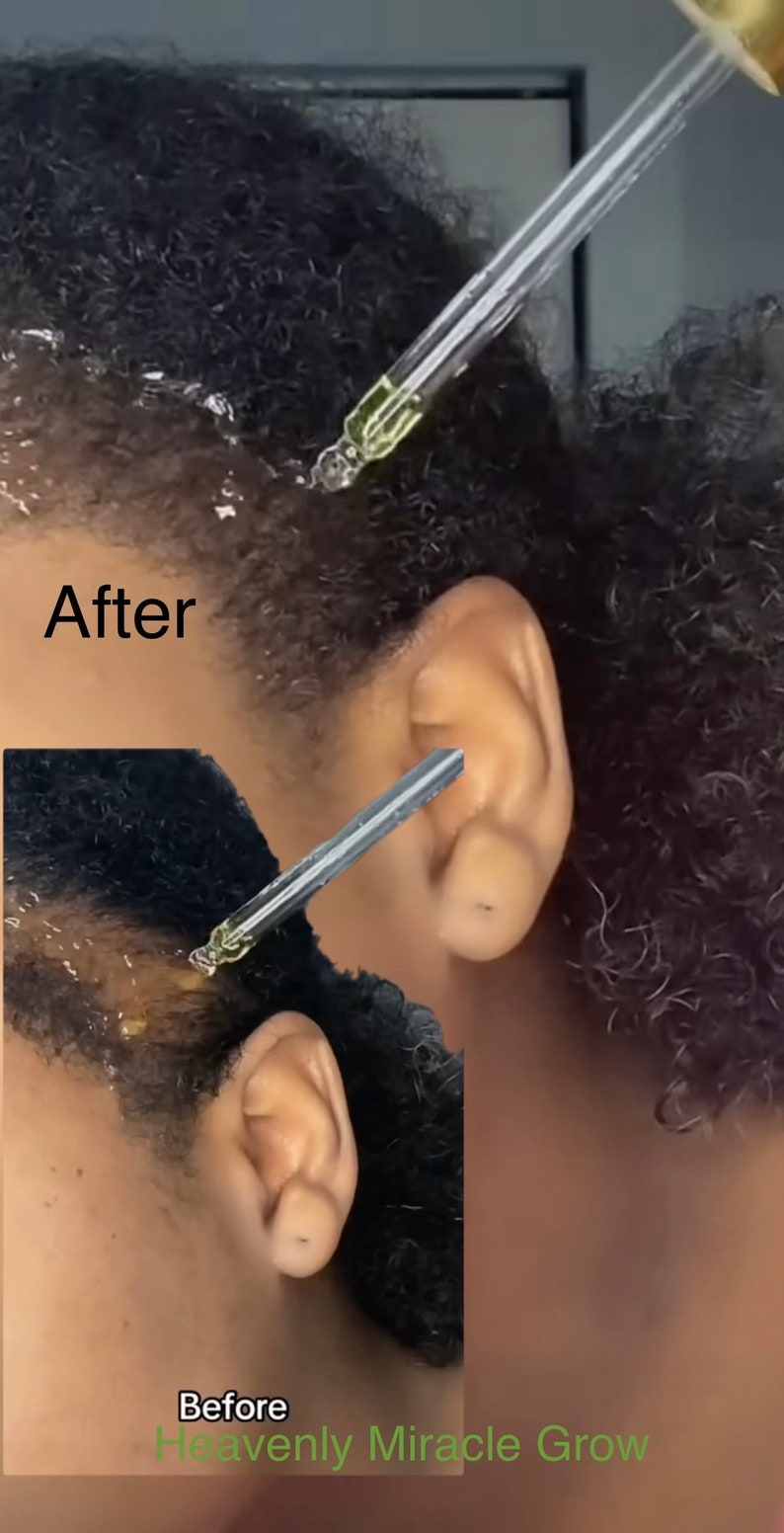 Dynamic Miracle Hair Growth Capture for Your Screen Dynamic Miracle Hair Growth Capture for Your Screen