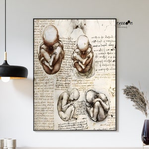 Leonardo Da Vinci, Views of a Foetus in the Womb, 1510-1513, Da Vinci Print, Classicism Art, Home Wall Decor, Wall Art, Renaissance Poster