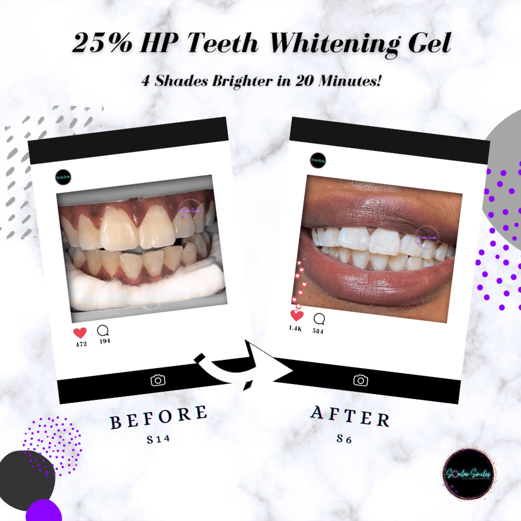 Professional Grade Teeth Whitening Gel 25 HP Hydrogen Peroxide Gel