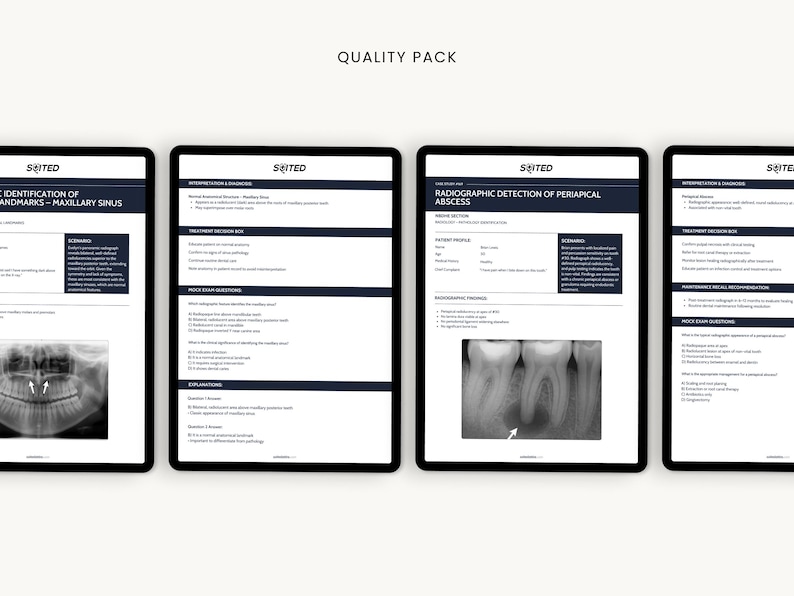 May include: Four black tablets displaying dental radiography information. The tablets show text and x-ray images of teeth. The text includes the words "QUALITY PACK", "IDENTIFICATION OF LANDMARKS - MAXILLARY SINUS", and "RADIOGRAPHIC DETECTION OF PERIAPICAL ABSCESS".