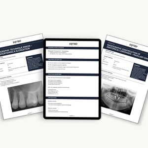 May include: Three documents and a tablet are displayed on a white surface. The documents have the text "RADIOGRAPHIC TECHNIQUE ERROR - FORESHORTENING & ELONGATION" and "RADIOGRAPHIC IDENTIFICATION OF ANATOMICAL LANDMARKS - MAXILLARY SINUS". The tablet displays text and diagrams.