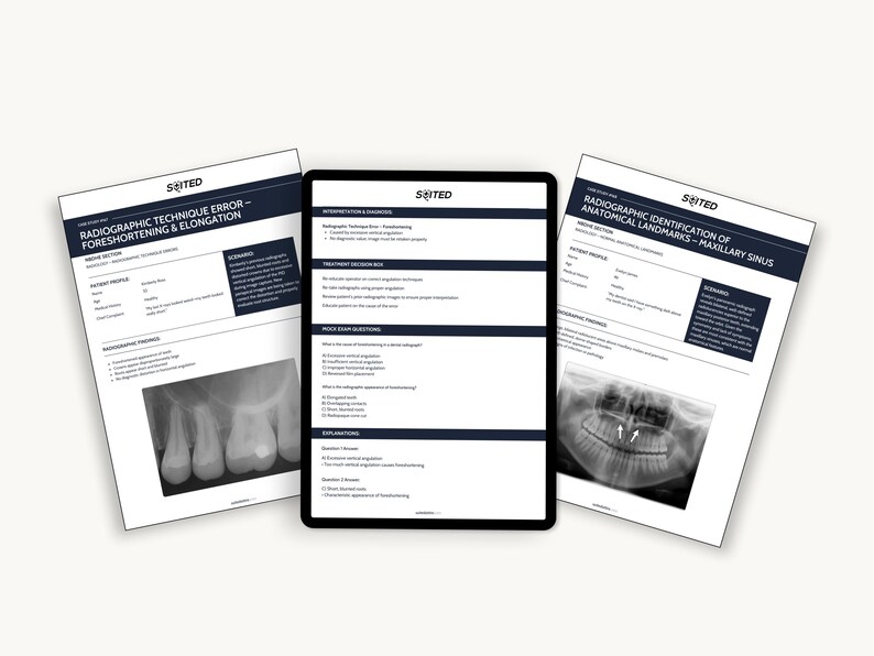 May include: Three documents and a tablet are displayed on a white surface. The documents have the text "RADIOGRAPHIC TECHNIQUE ERROR - FORESHORTENING & ELONGATION" and "RADIOGRAPHIC IDENTIFICATION OF ANATOMICAL LANDMARKS - MAXILLARY SINUS". The tablet displays text and diagrams.
