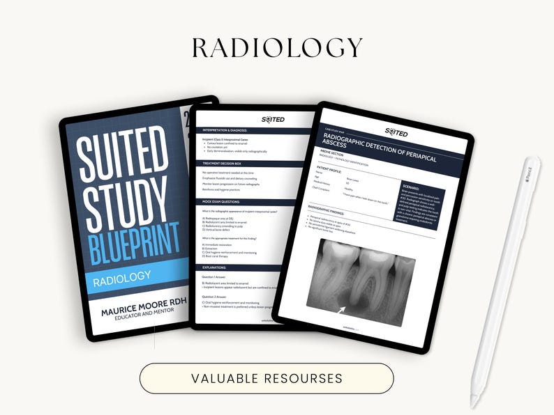 May include: Three black tablets displaying dental radiology study materials. The tablets show the text "SUITED STUDY BLUEPRINT RADIOLOGY" and "RADIOGRAPHIC DETECTION OF PERIAPICAL ABSCESS". A white stylus rests on the right side. The word "RADIOLOGY" is at the top.