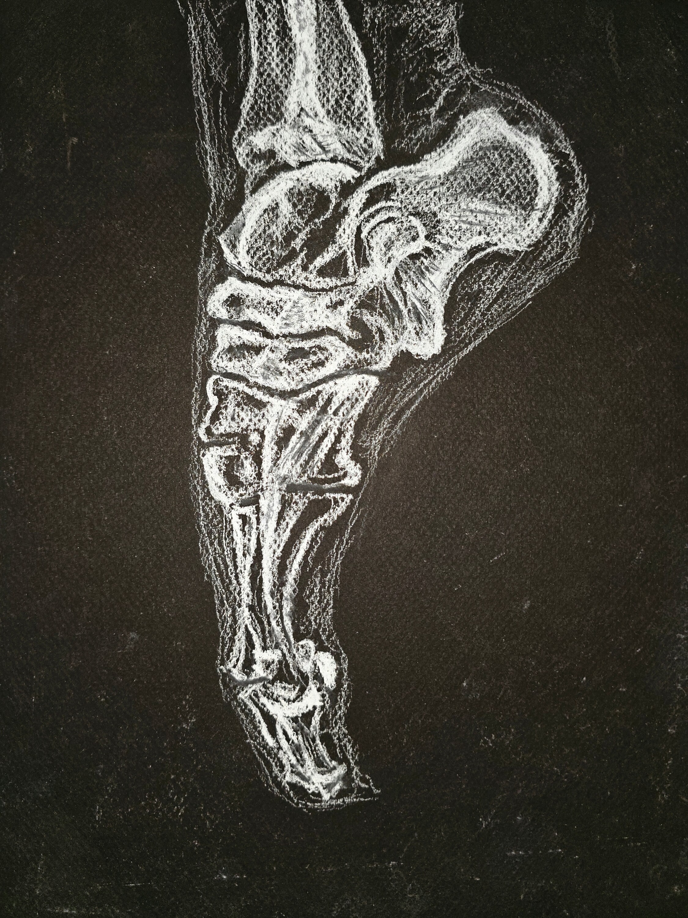 Ballerina Foot X-ray Art Print 11 X 14 Inches, Radiography, Ballet