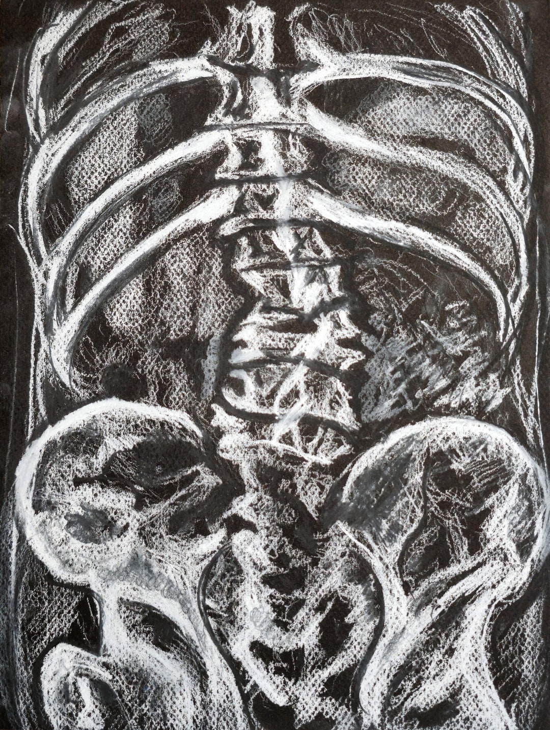Spine Anatomy X ray Art Print 11 X 14 Inches Skeleton Horror Medical Spine Anatomy X ray Art Print 11 X 14 Inches Skeleton Horror Medical