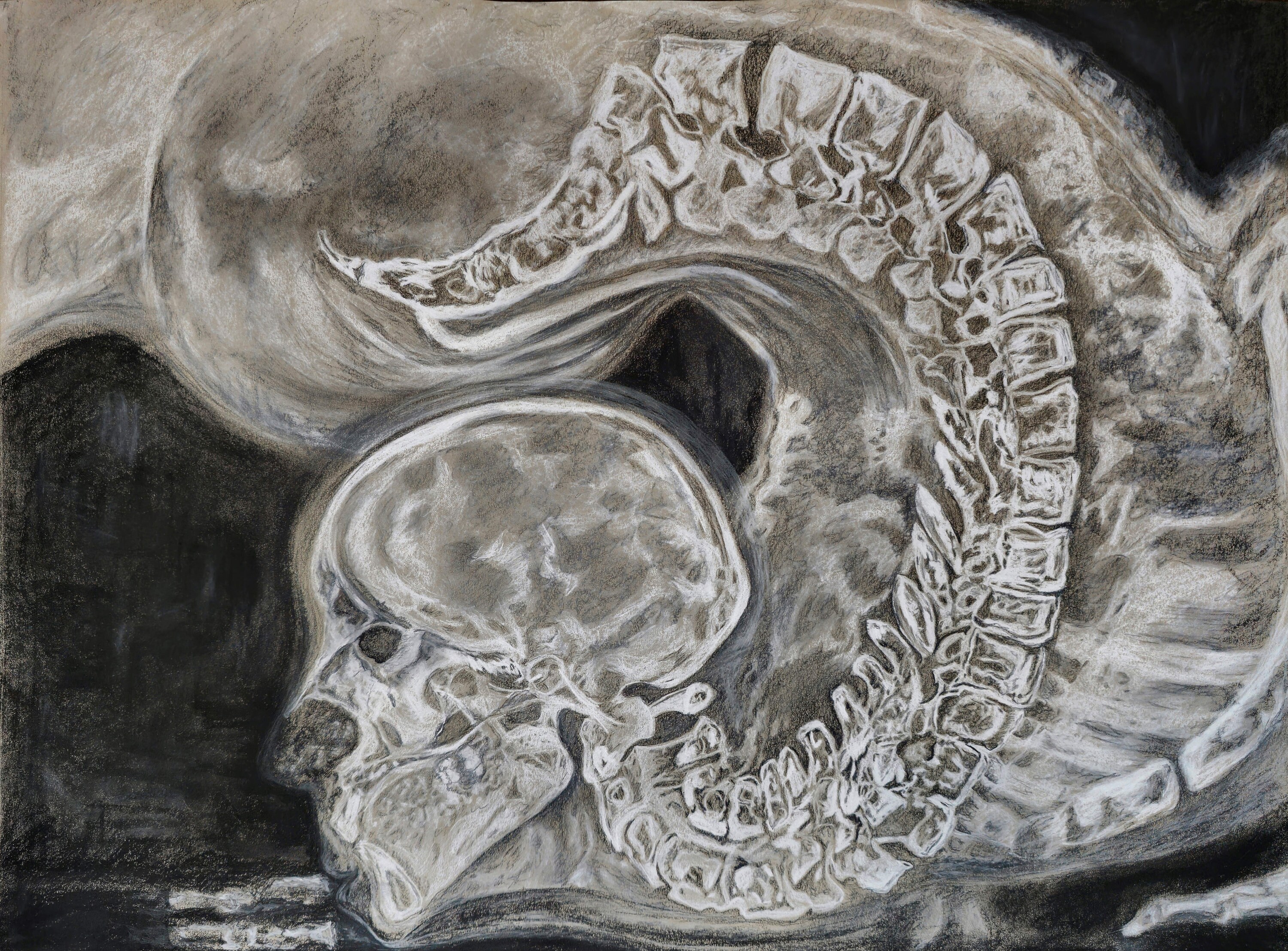 Contortionist Xray Art Print 11x14 Inches, Dark Art, Gothic, Horror