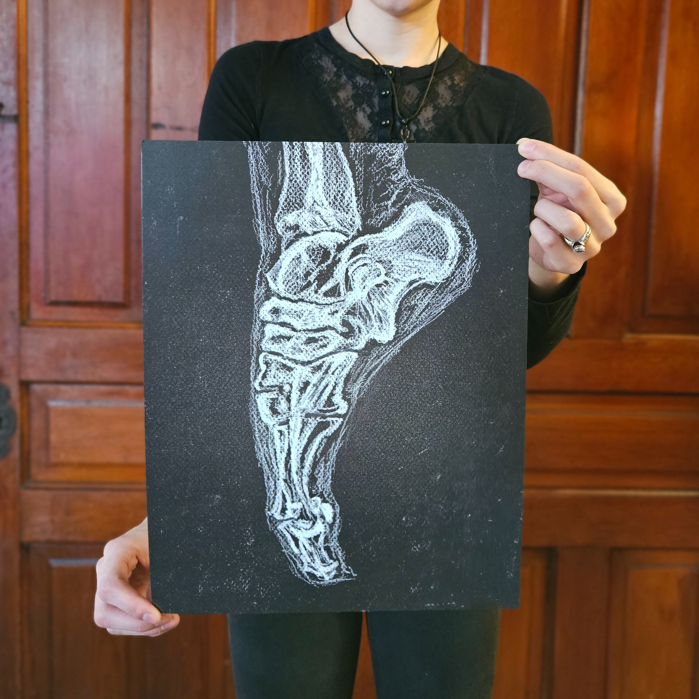 Ballerina Foot X-ray Art Print 11 X 14 Inches, Radiography, Ballet