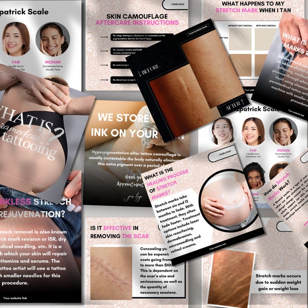 Instagram-postsjablonen voor medische tatoeage: 25 bewerkbare canvaontwerpen voor medische tatoeëerders en klinieken