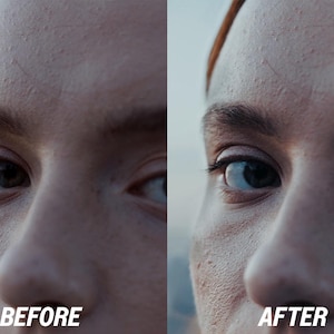 Puede incluir: Imagen dividida que muestra un primer plano de un rostro, con un lado etiquetado como "ANTES" y el otro como "DESPU&Eacute;S". El lado "ANTES" tiene una apariencia m&aacute;s oscura y menos definida en comparaci&oacute;n con el lado "DESPU&Eacute;S", que parece m&aacute;s brillante y detallado.