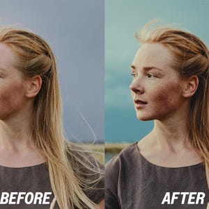 May include: Split image showing a woman's profile before and after a beauty treatment. The woman has long blonde hair and is wearing a dark grey top. The text "BEFORE" and "AFTER" are displayed in white at the bottom of each image.