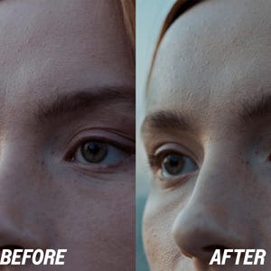 Puede incluir: Imagen dividida que muestra un primer plano del rostro de una persona, con el texto "BEFORE" a la izquierda y "AFTER" a la derecha. La imagen destaca la diferencia en la apariencia de la piel antes y despu&eacute;s de un tratamiento.