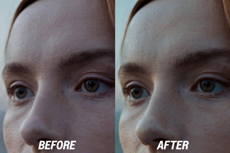 Puede incluir: Imagen dividida que muestra un primer plano del rostro de una persona, con el texto "BEFORE" a la izquierda y "AFTER" a la derecha. La imagen destaca la diferencia en la apariencia de la piel antes y despu&eacute;s de un tratamiento.