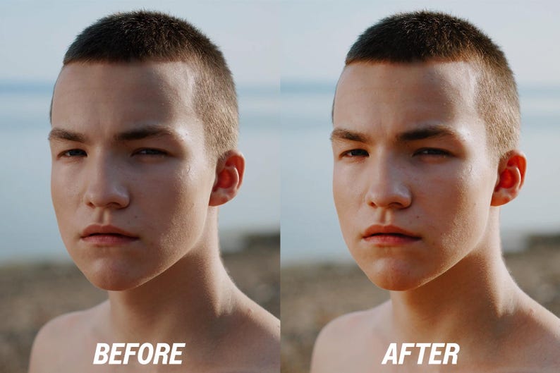 K&ouml;nnte beinhalten: Ein geteiltes Bild, das das Gesicht einer Person vor und nach einem kosmetischen Eingriff zeigt. Der Text "BEFORE" befindet sich unten links und "AFTER" unten rechts. Die Person hat kurze, dunkle Haare und schaut nach vorne.