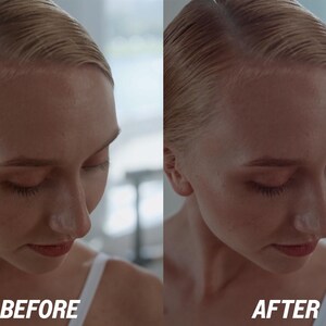 Puede incluir: Imagen dividida que muestra el rostro de una mujer antes y despu&eacute;s de un tratamiento de belleza. El texto "BEFORE" est&aacute; en la parte inferior izquierda y "AFTER" en la parte inferior derecha. La mujer tiene el pelo rubio y lleva una camiseta blanca.