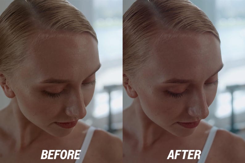 Puede incluir: Imagen dividida que muestra el rostro de una mujer antes y despu&eacute;s de un tratamiento de belleza. El texto "BEFORE" est&aacute; en la parte inferior izquierda y "AFTER" en la parte inferior derecha. La mujer tiene el pelo rubio y lleva una camiseta blanca.