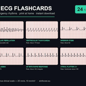 May include: A set of ER ECG flashcards featuring 24 emergency rhythms on a dark background. The cards display various heart rhythm tracings on pink grid paper with labels including Ventricular Fibrillation, Ventricular Tachycardia, and Inferior STEMI.